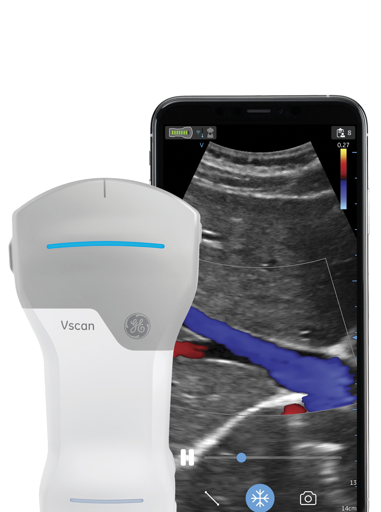 Vscan Air